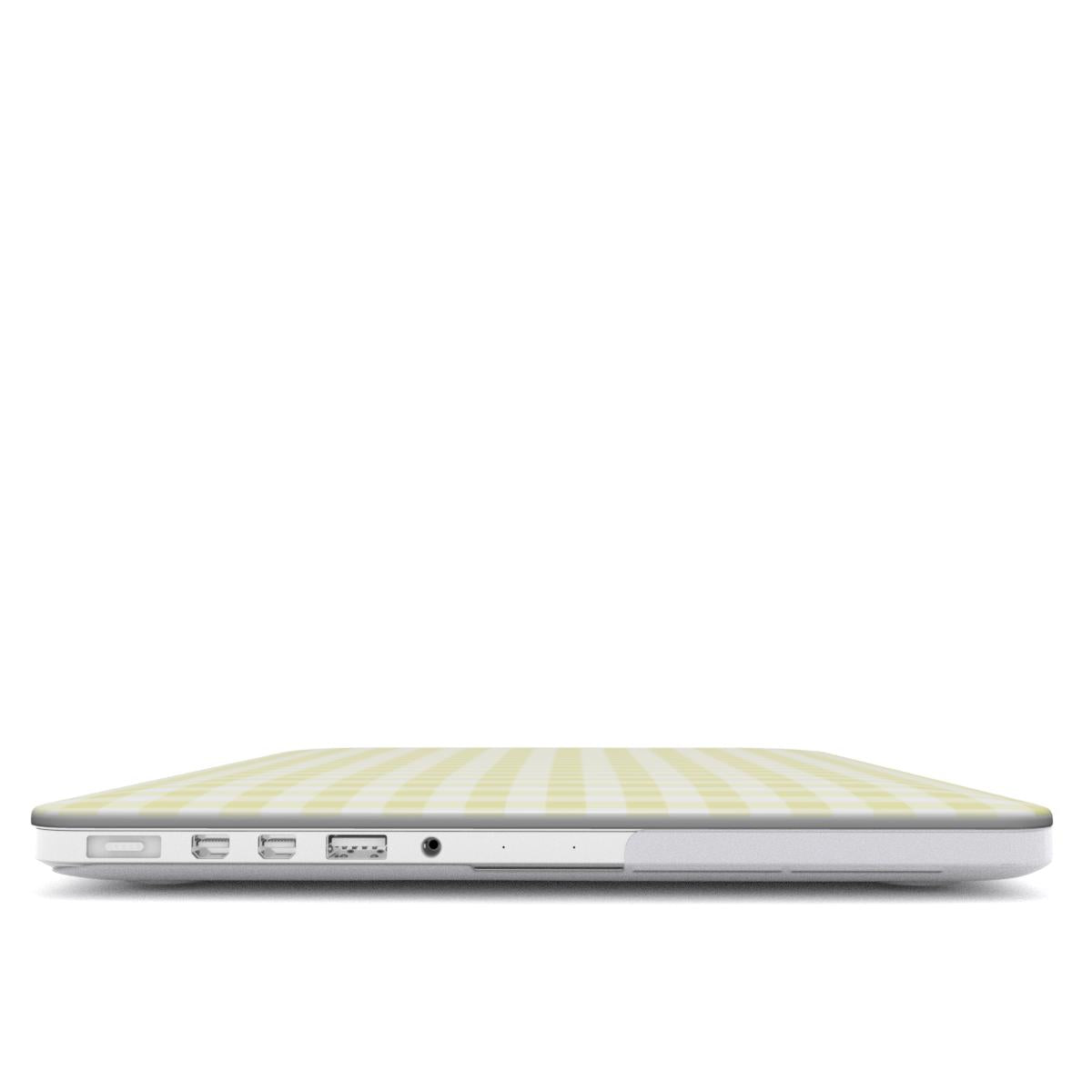 Yellow Pretty in Plaid MacBook Case