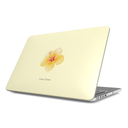 Tropical Flower in Yellow MacBook Case