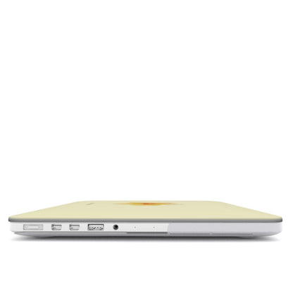 Tropical Flower in Yellow MacBook Case