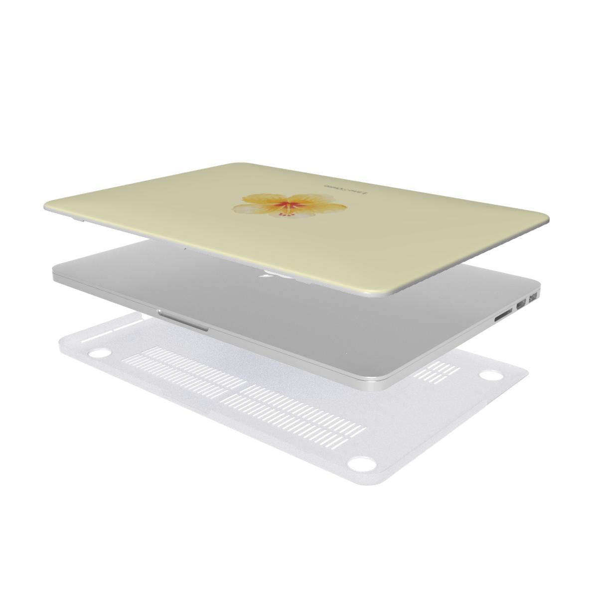 Tropical Flower in Yellow MacBook Case