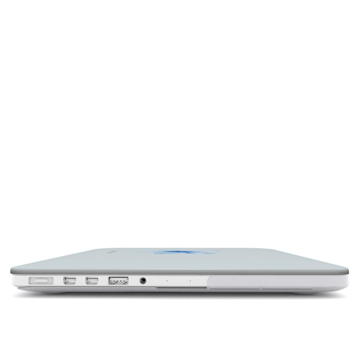 Tropical Flower in Blue MacBook Case