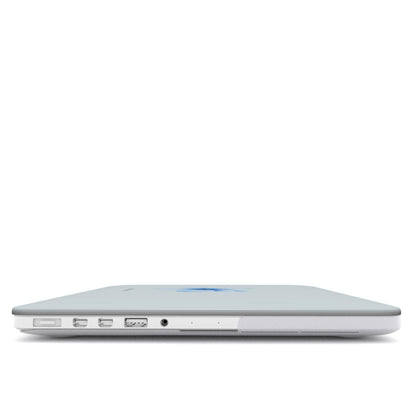 Tropical Flower in Blue MacBook Case