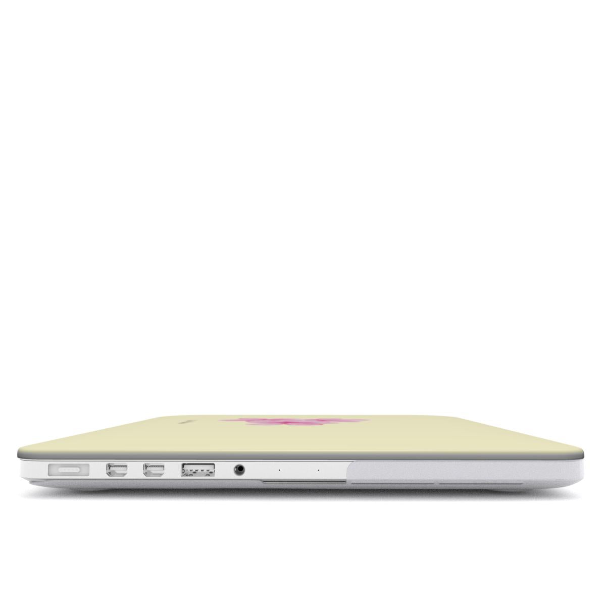 Tropical Flower in Yellow/Pink MacBook Case
