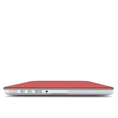 Strawberry Stripes MacBook Case