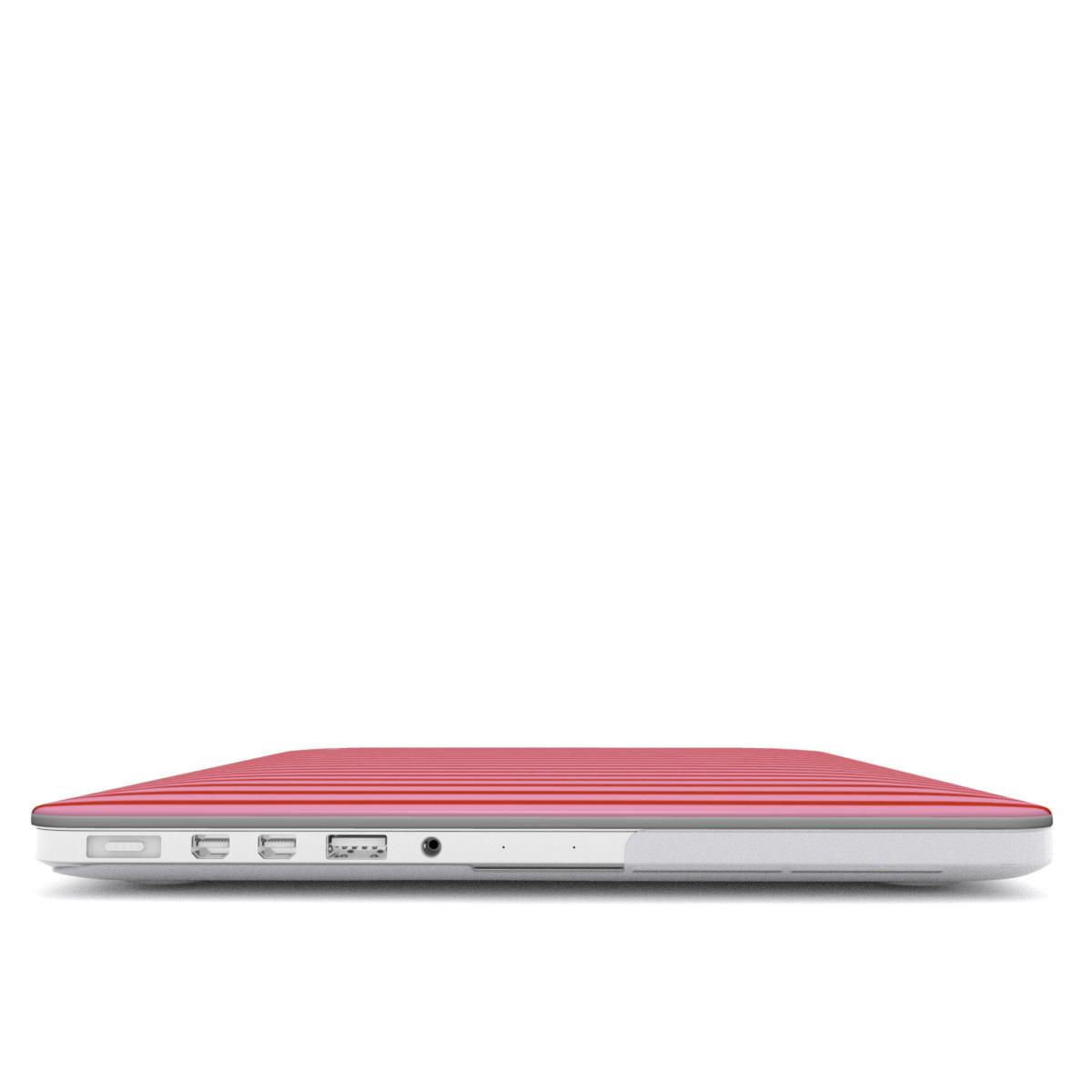 Pink Strawberry Stripes MacBook Case