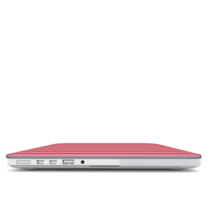 Pink Strawberry Stripes MacBook Case