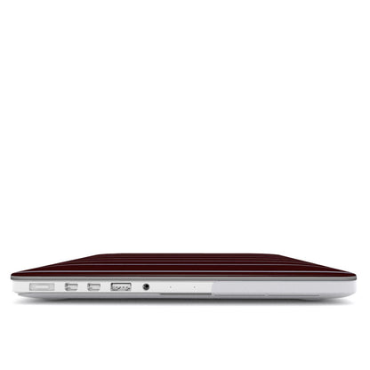 Brown & Blue Small Stripes MacBook Case