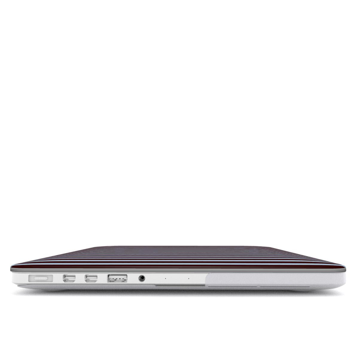 Brown & Blue Stripes MacBook Case
