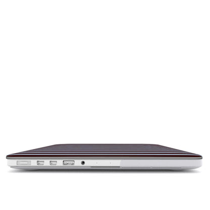 Brown & Blue Stripes MacBook Case
