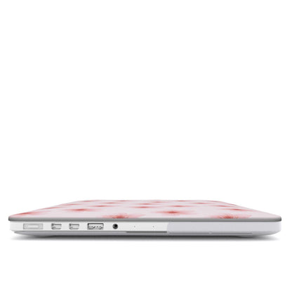 Pink Watercolour Flower MacBook Case