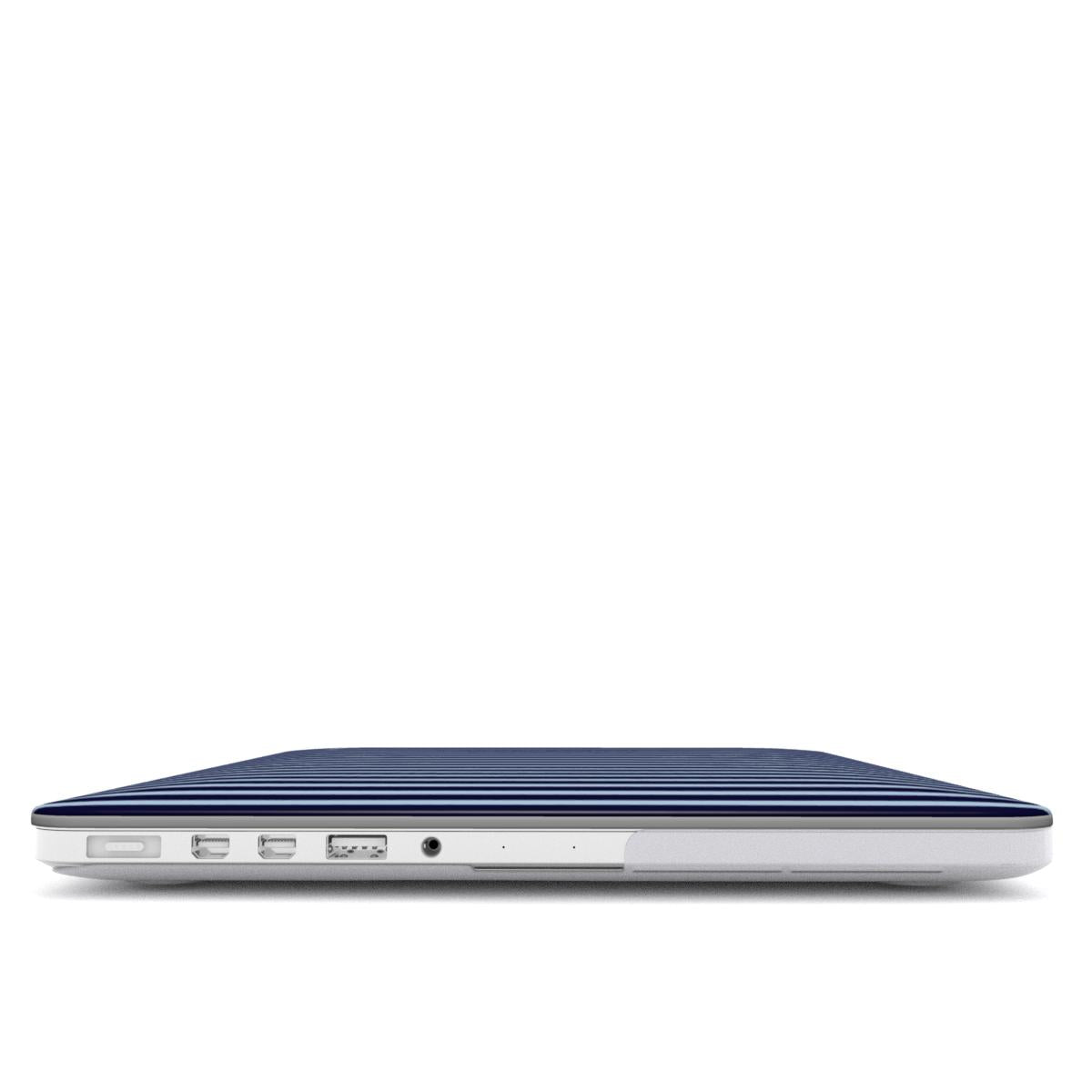 Dark & Light Blue Stripes MacBook Case
