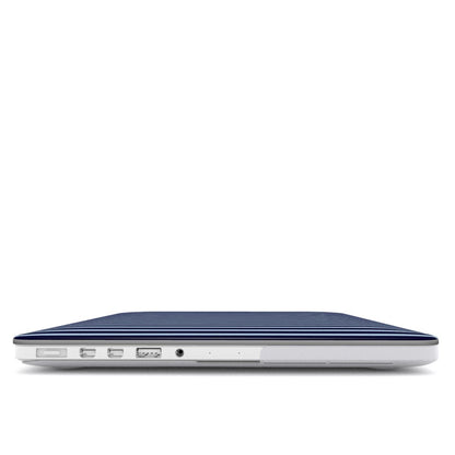 Dark & Light Blue Stripes MacBook Case
