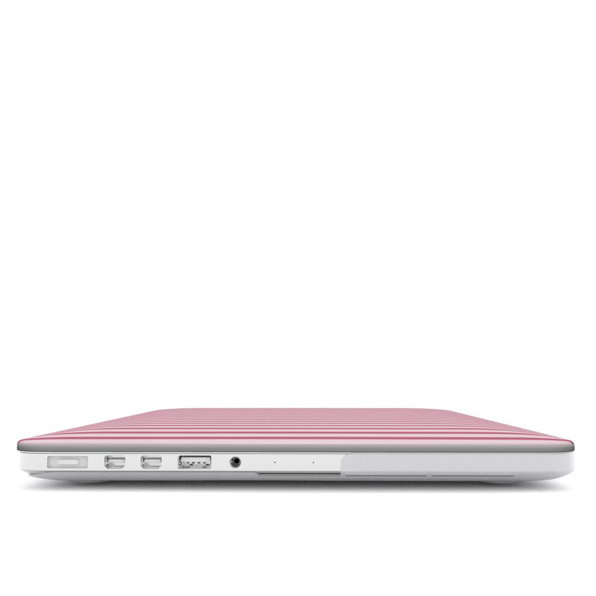 Pink Stripes MacBook Case