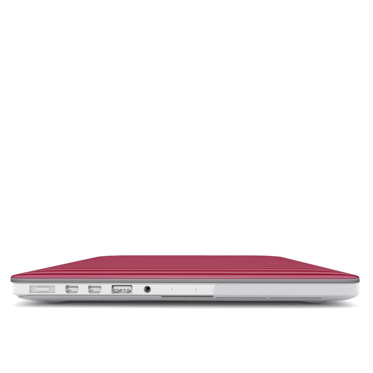 Strawberry Stripes MacBook Case