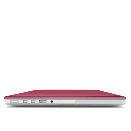 Strawberry Stripes MacBook Case