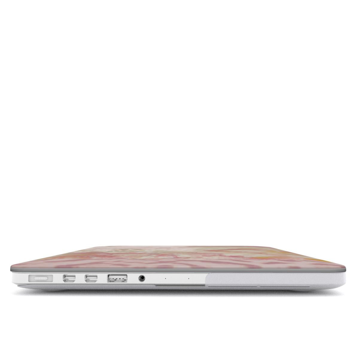 Pink Static MacBook Case