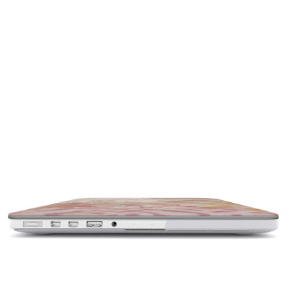 Pink Static MacBook Case