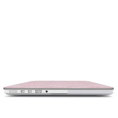 Pink Lace MacBook Case