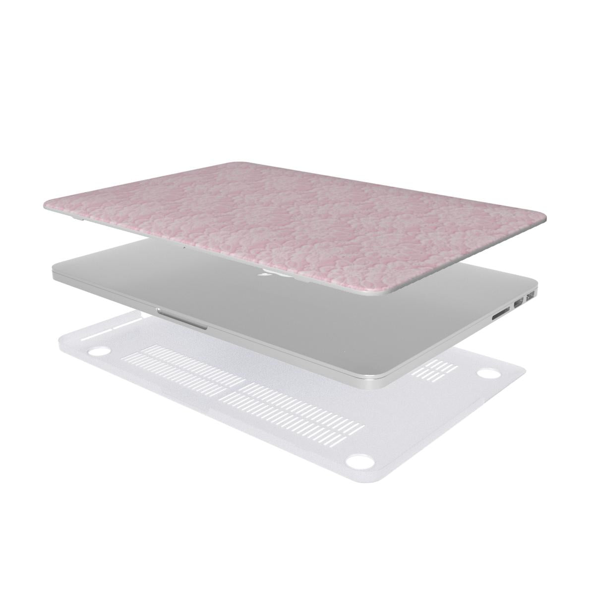 Pink Lace MacBook Case