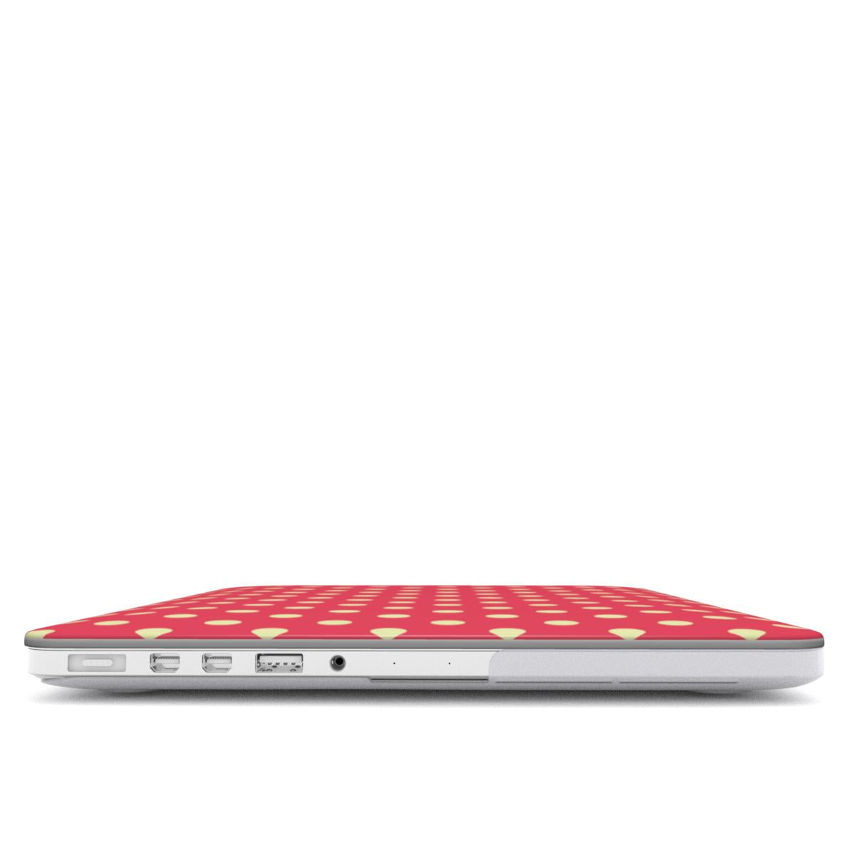 Vivid Pink & Yellow Spots MacBook Case
