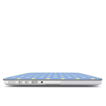 Blue & Yellow Spots MacBook Case