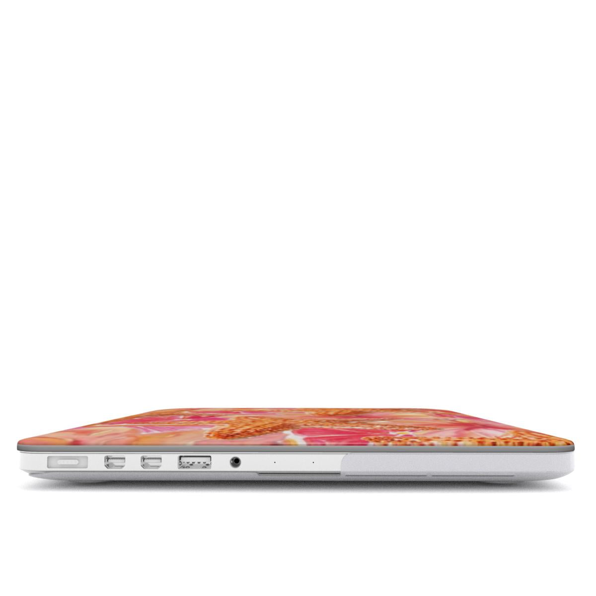 Starfish Y2K MacBook Case